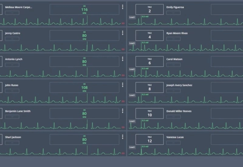 Syncope Monitoring with ultra-low noise ECG