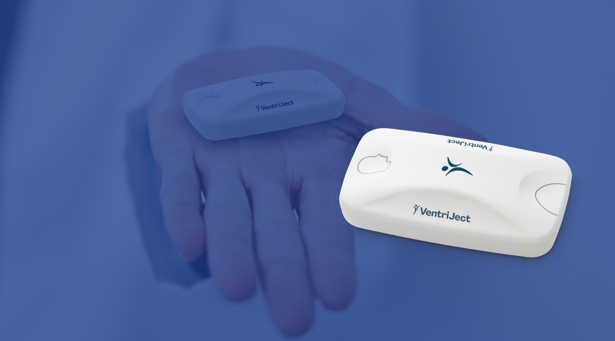 Revolutionizing VO₂max estimation